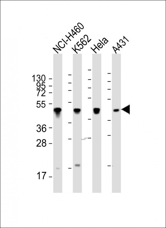 Cytokeratin 18 Antibody in Western Blot (WB)