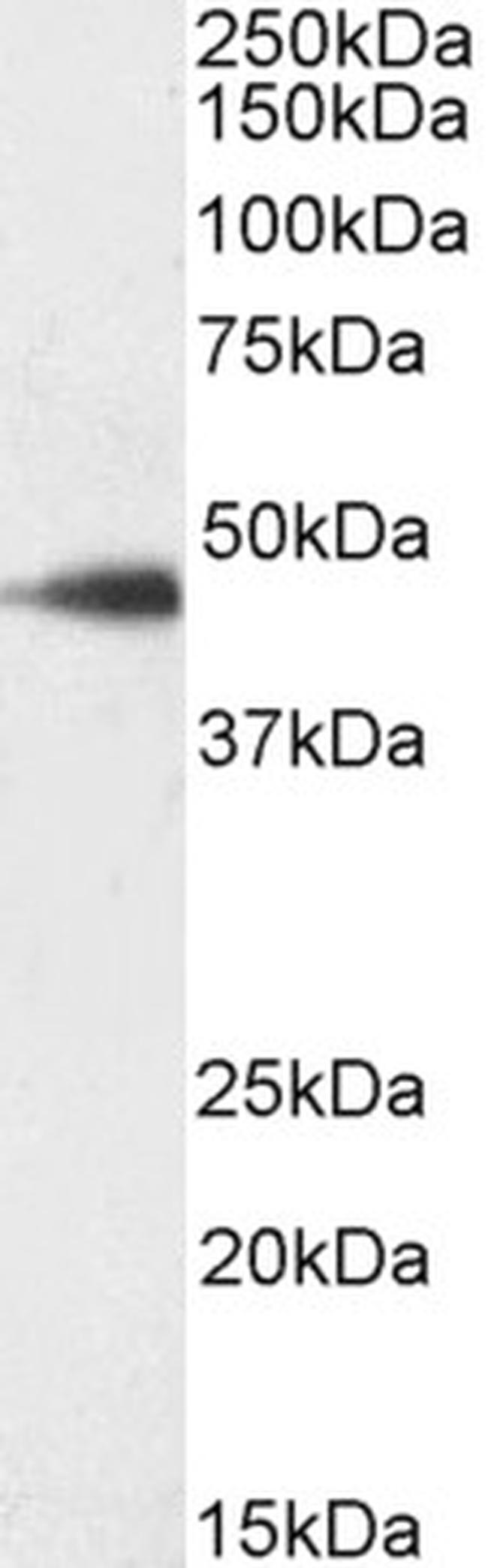 SDF4 Antibody in Western Blot (WB)