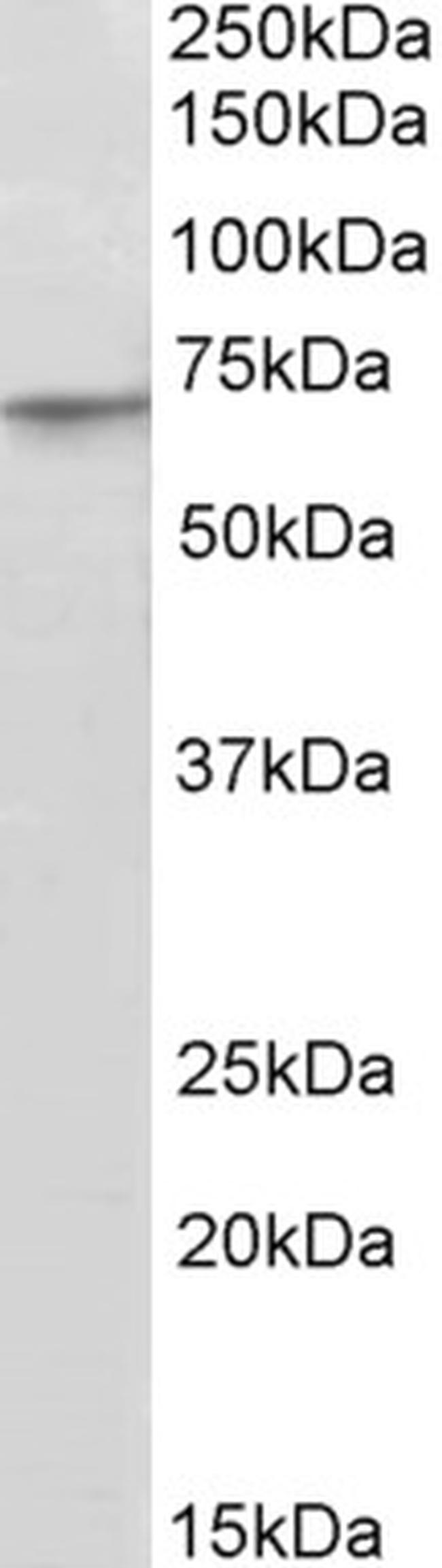 PRDM14 Antibody in Western Blot (WB)