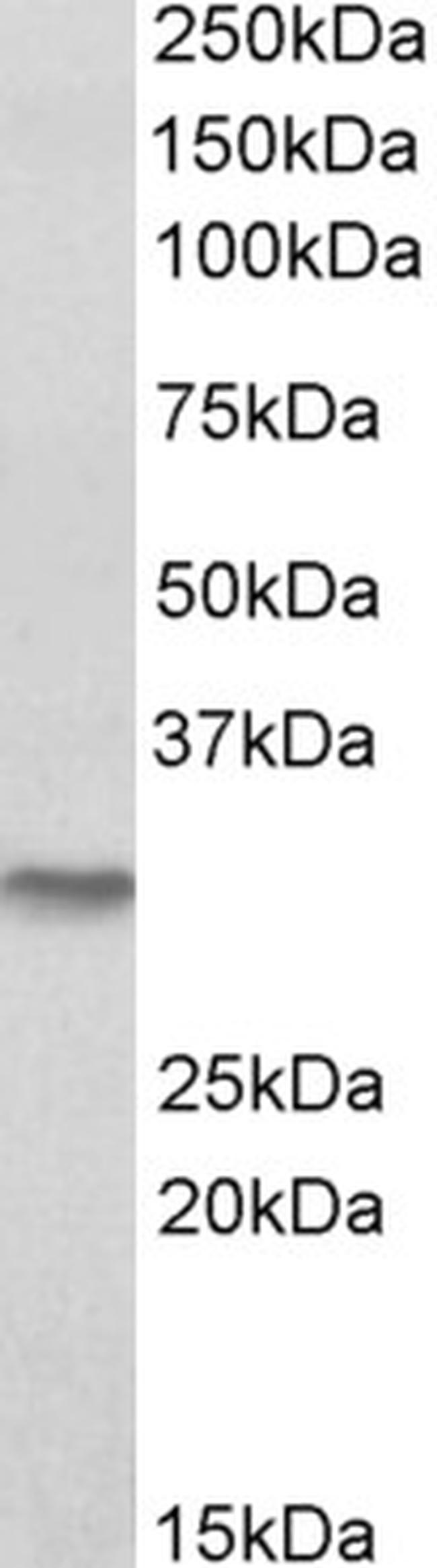 NQO1 Antibody in Western Blot (WB)