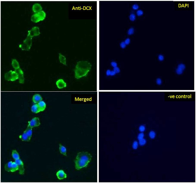 Doublecortin Antibody in Immunocytochemistry (ICC/IF)