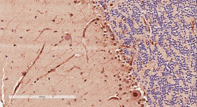 Doublecortin Antibody in Immunohistochemistry (Paraffin) (IHC (P))