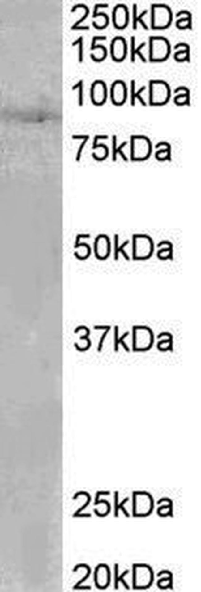 SETDB2 Antibody in Western Blot (WB)