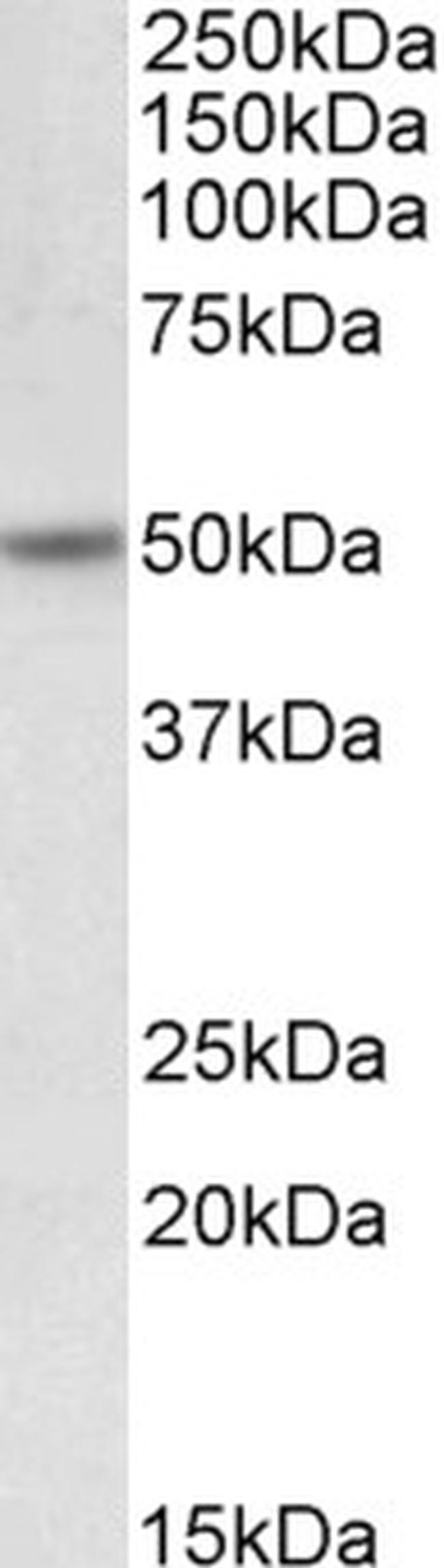 Orexin Receptor 2 Antibody in Western Blot (WB)