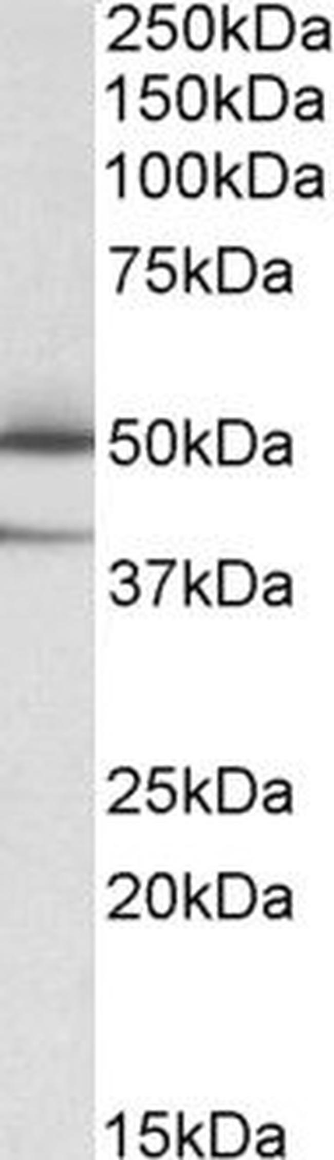 TXNDC5 Antibody in Western Blot (WB)