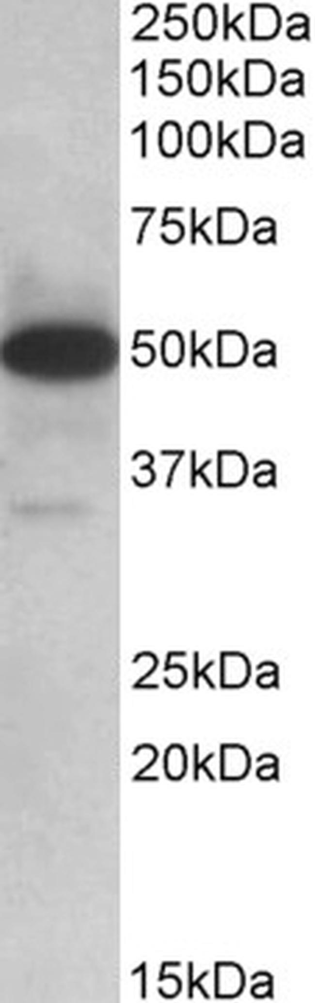 TXNDC5 Antibody in Western Blot (WB)