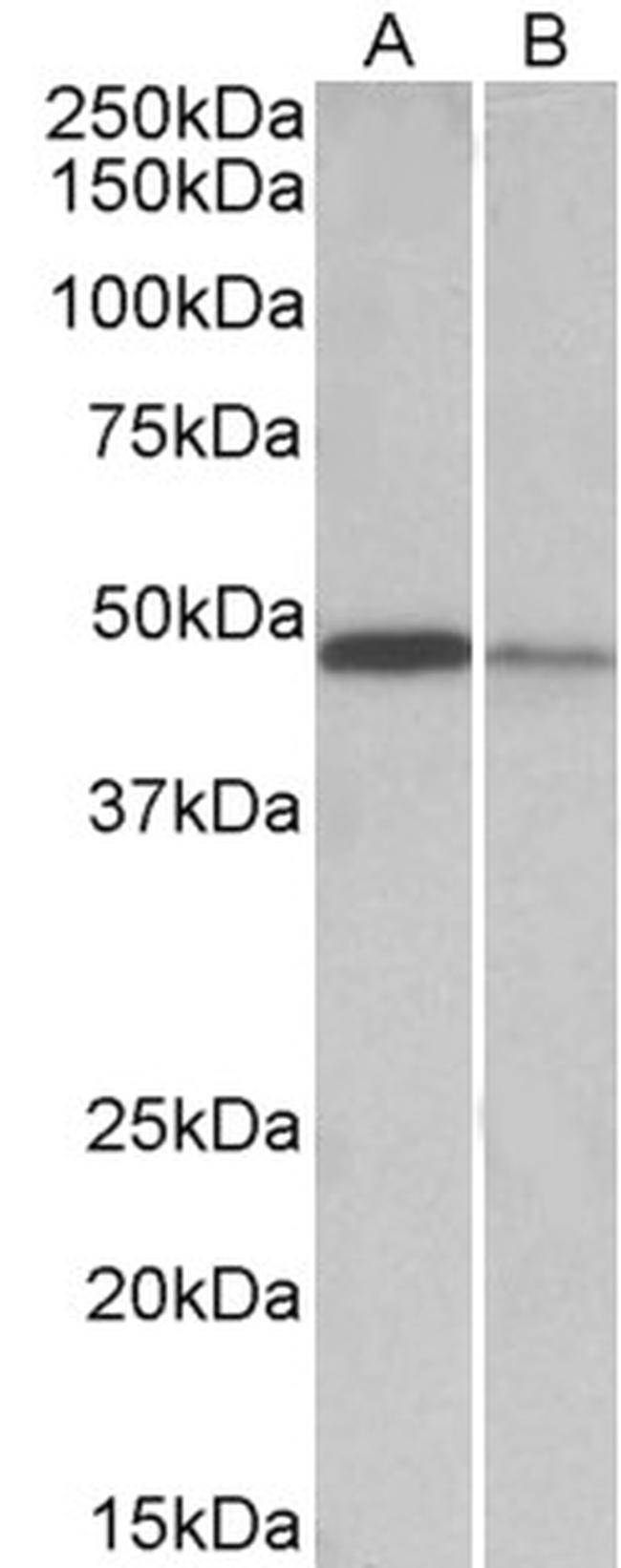 TXNDC5 Antibody in Western Blot (WB)