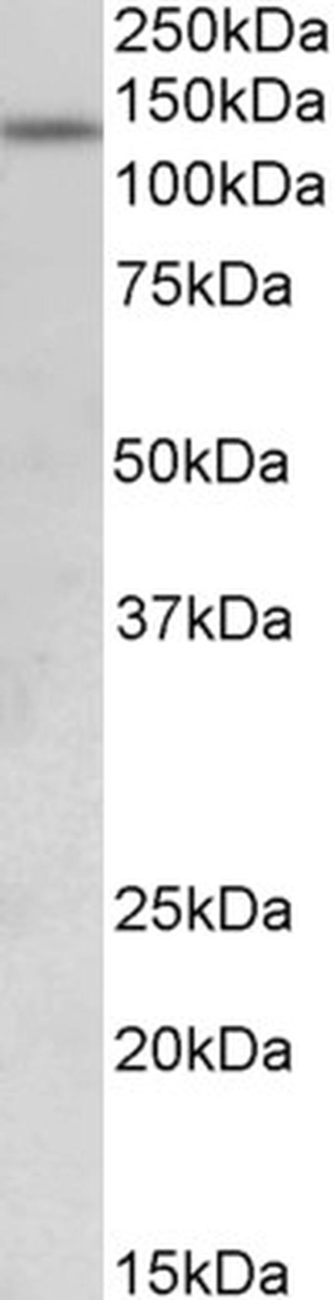 KDM2A Antibody in Western Blot (WB)