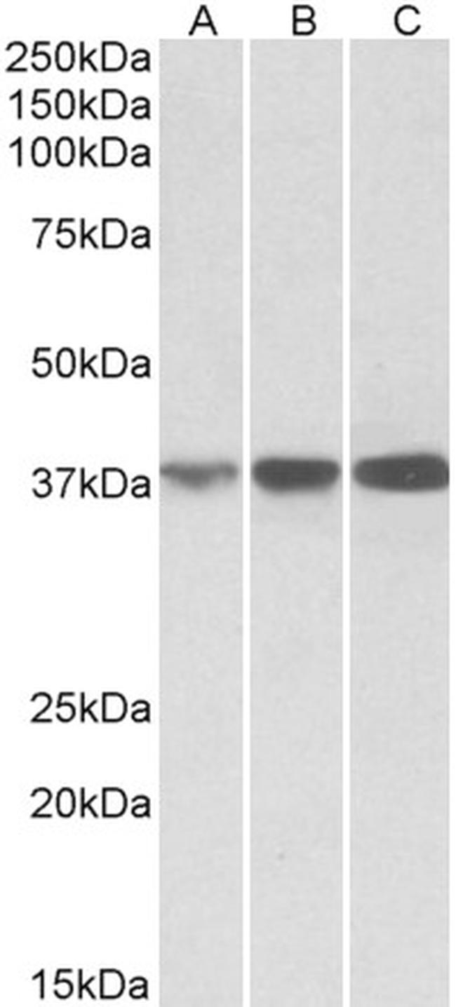 IDH3A Antibody in Western Blot (WB)