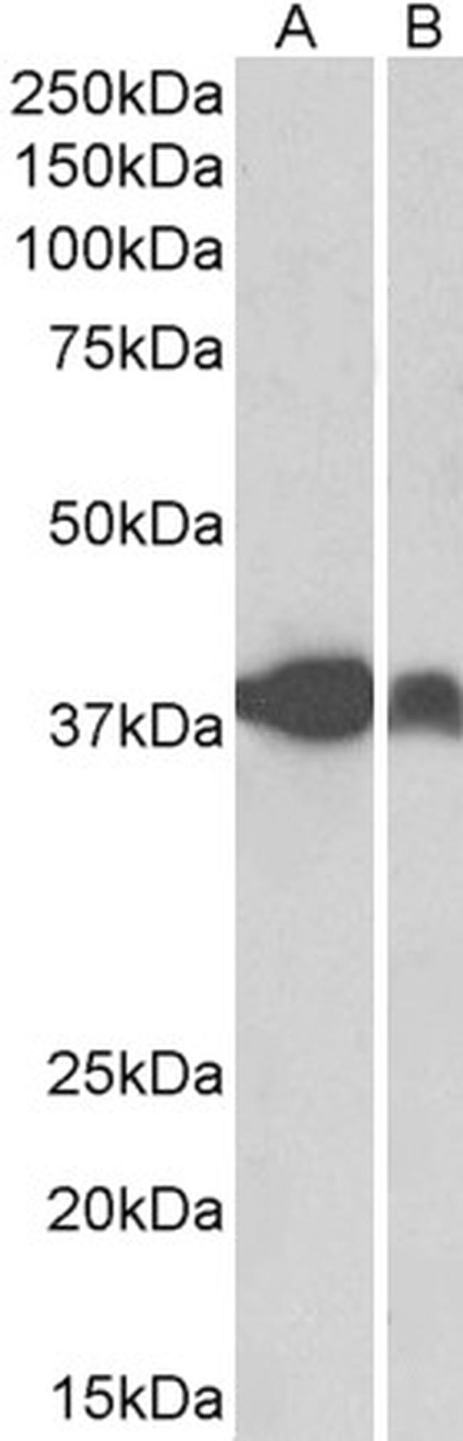 IDH3A Antibody in Western Blot (WB)