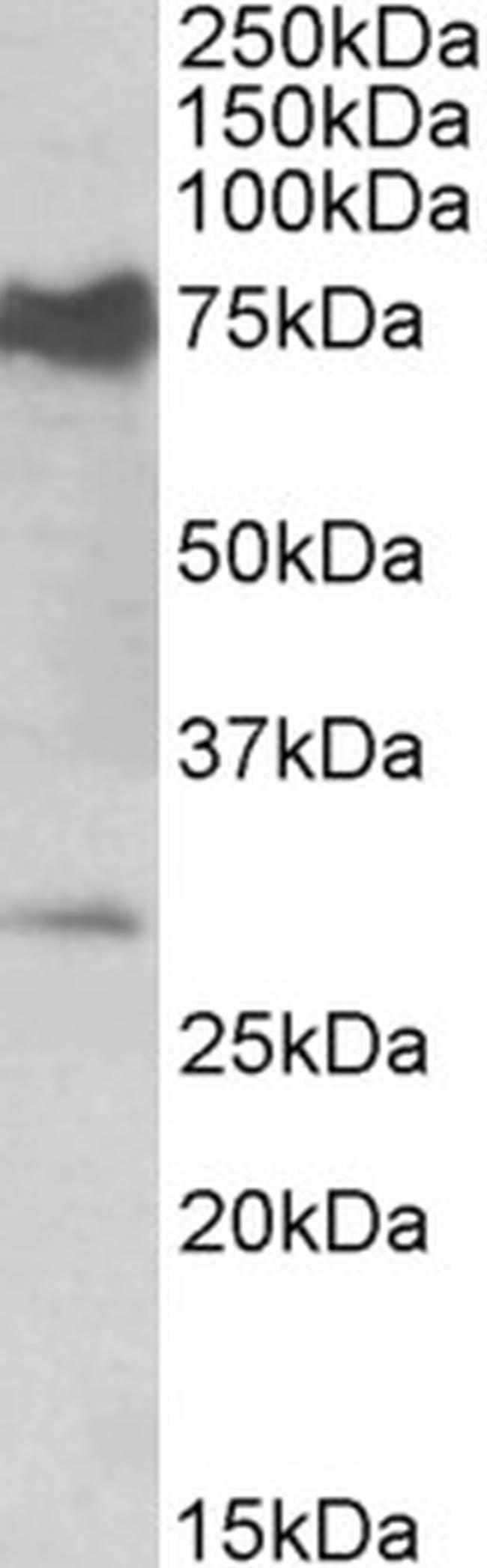 NMNAT3 Antibody in Western Blot (WB)