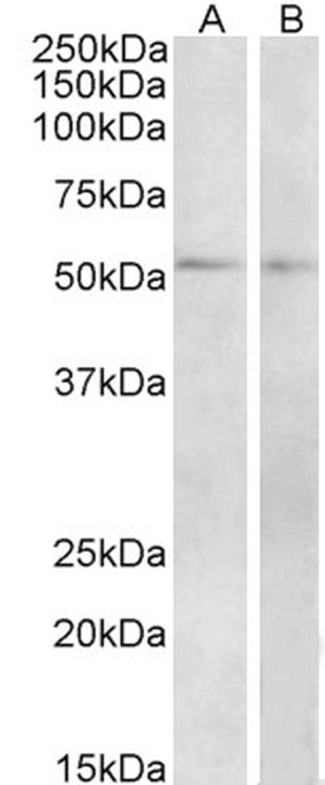 VIPR1 Antibody in Western Blot (WB)