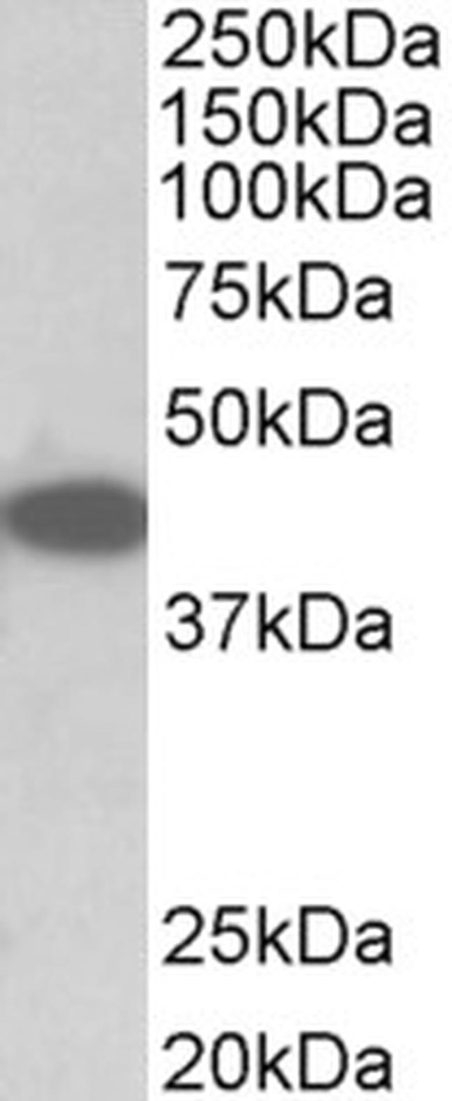 TRIB1 Antibody in Western Blot (WB)