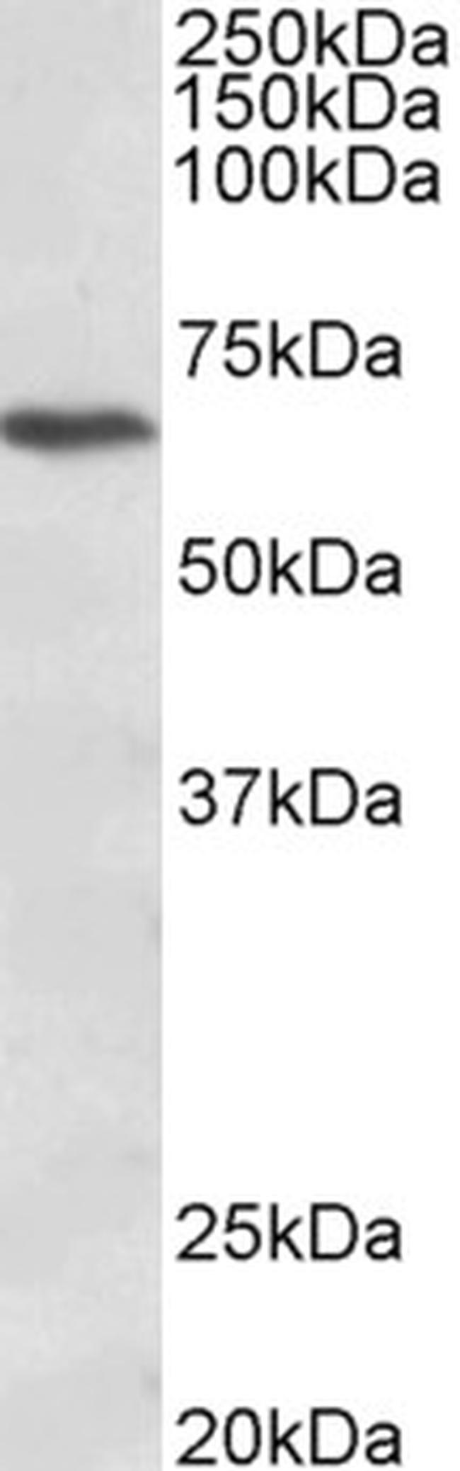 CACNB2 Antibody in Western Blot (WB)