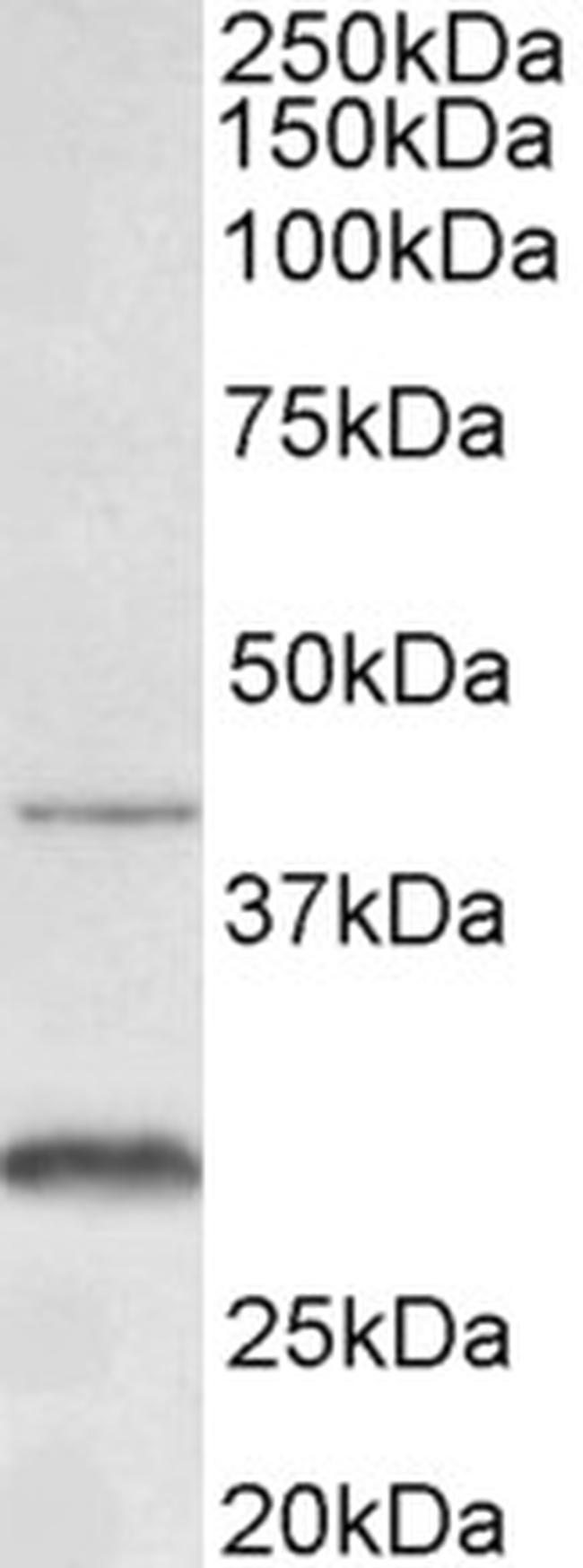 CXCR2 Antibody in Western Blot (WB)