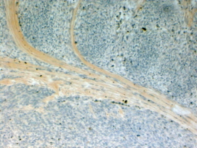 NUMBL Antibody in Immunohistochemistry (Paraffin) (IHC (P))