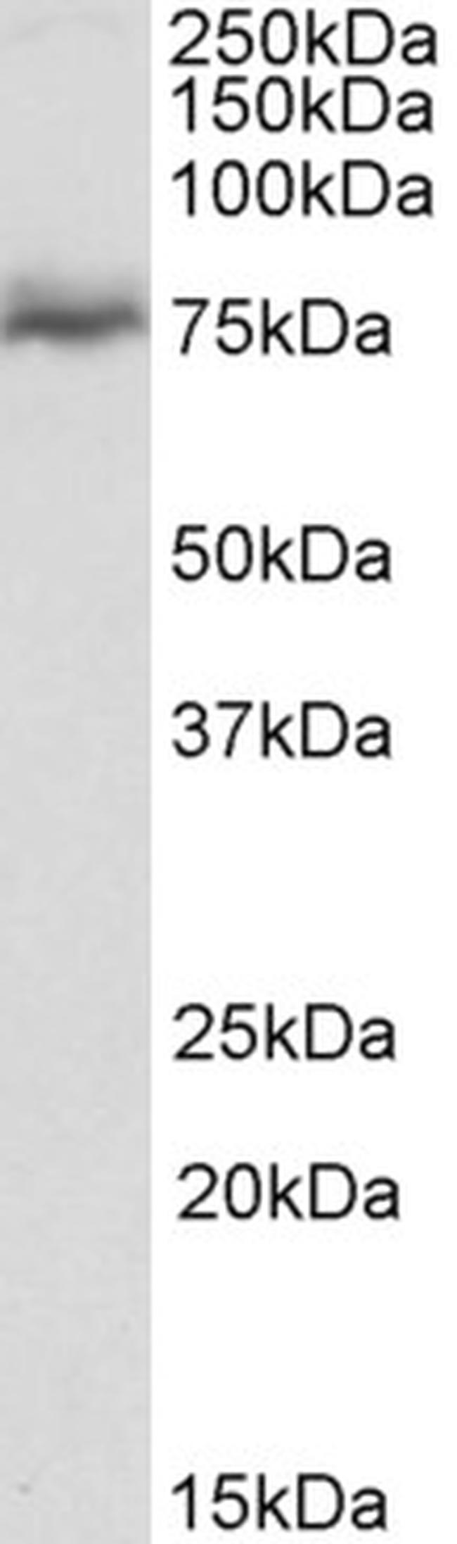 NUMBL Antibody in Western Blot (WB)