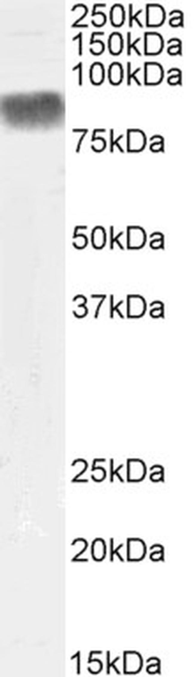 PKC beta Antibody in Western Blot (WB)