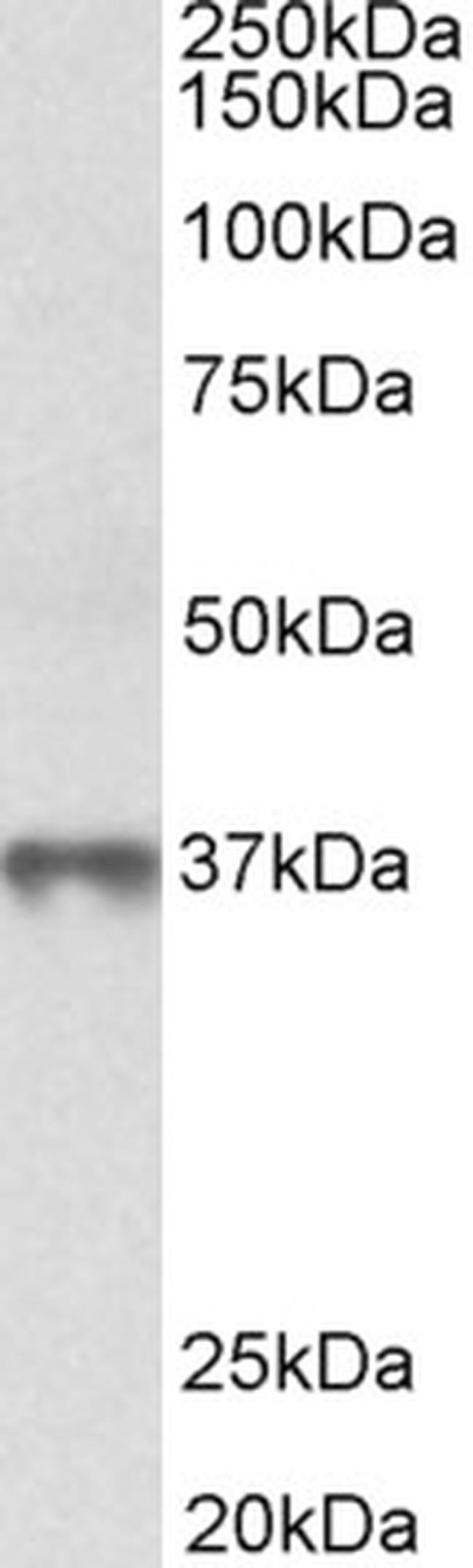 MAT2B Antibody in Western Blot (WB)