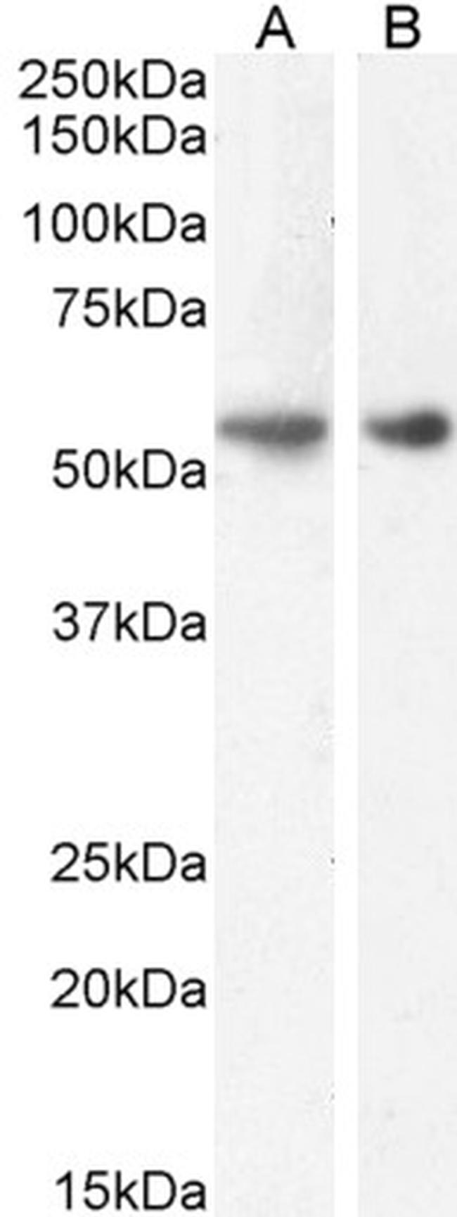 GLP1R Antibody in Western Blot (WB)