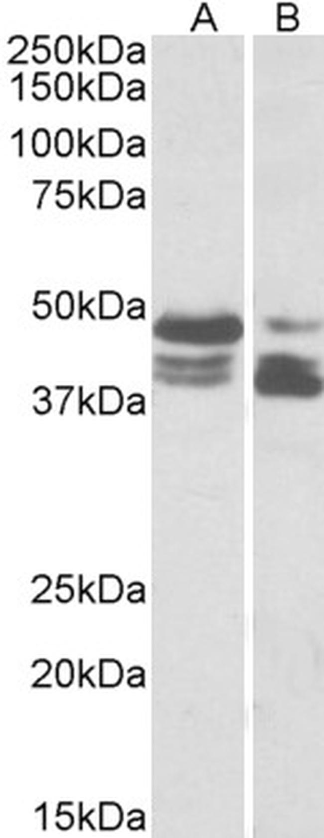 TIP47 Antibody in Western Blot (WB)