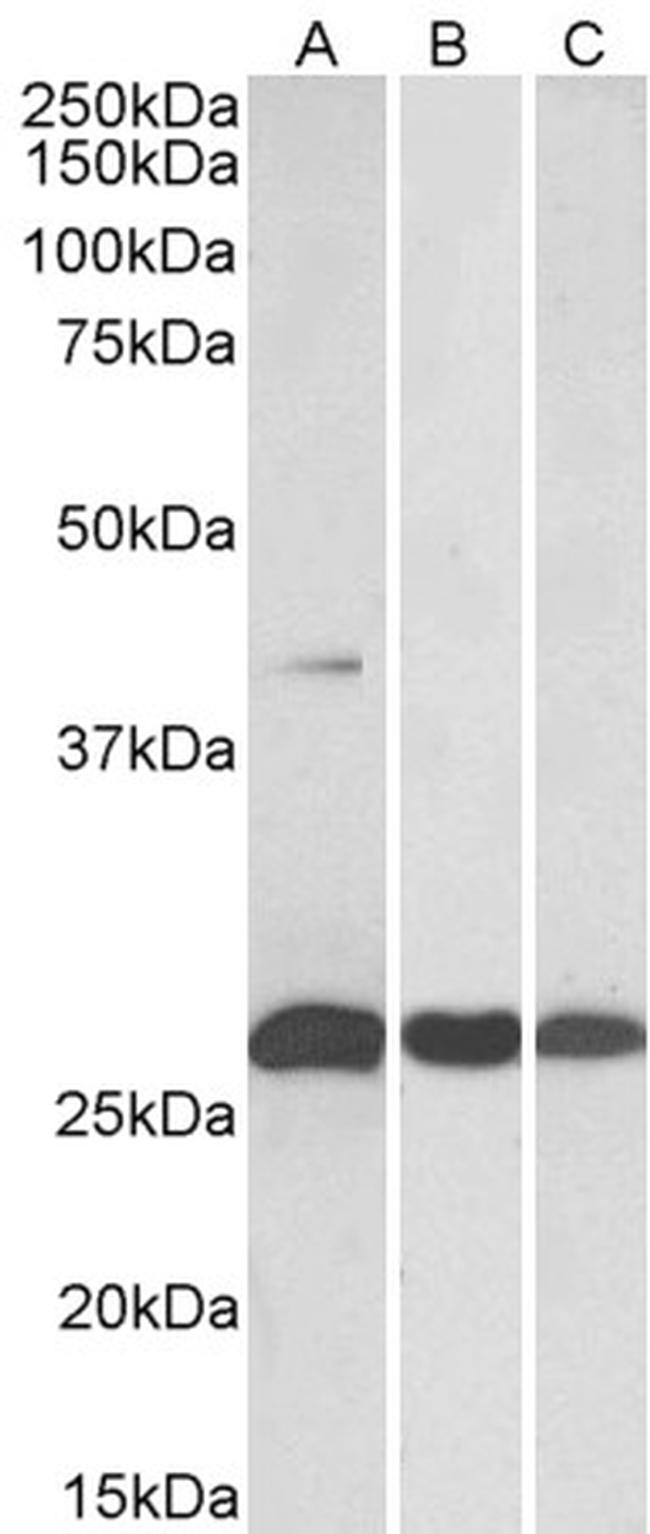 MKP3 Antibody in Western Blot (WB)