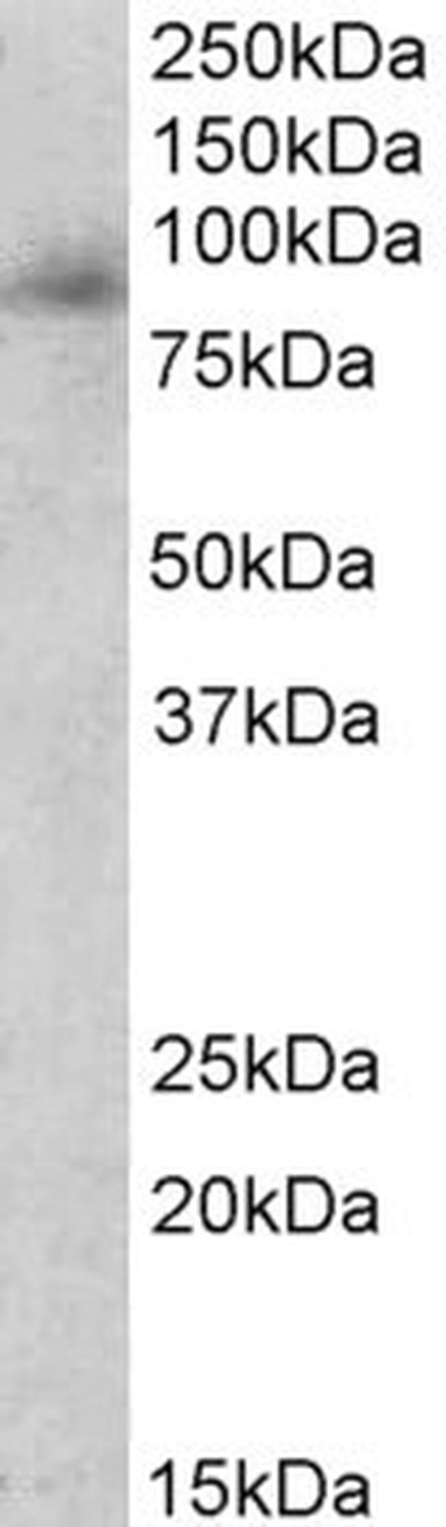 Myeloperoxidase Antibody in Western Blot (WB)