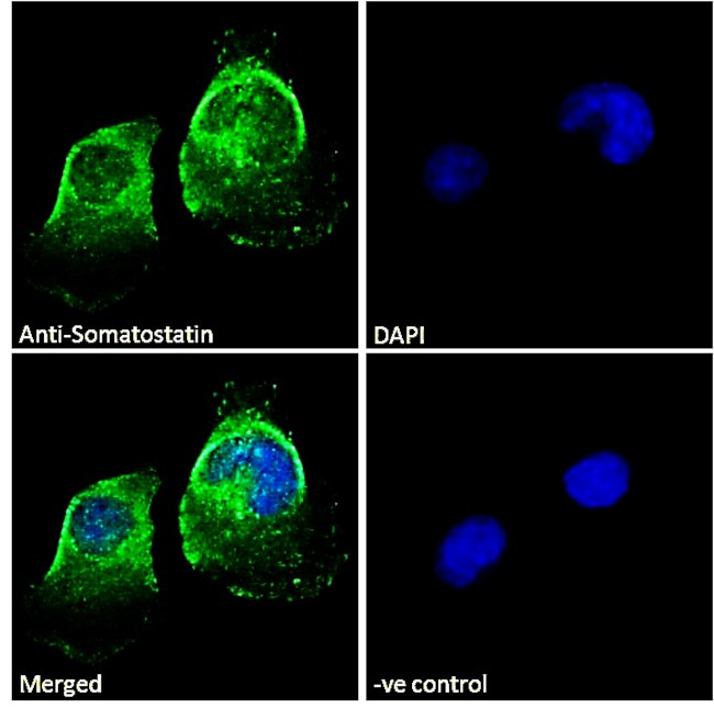 pro-Somatostatin Antibody in Immunocytochemistry (ICC/IF)