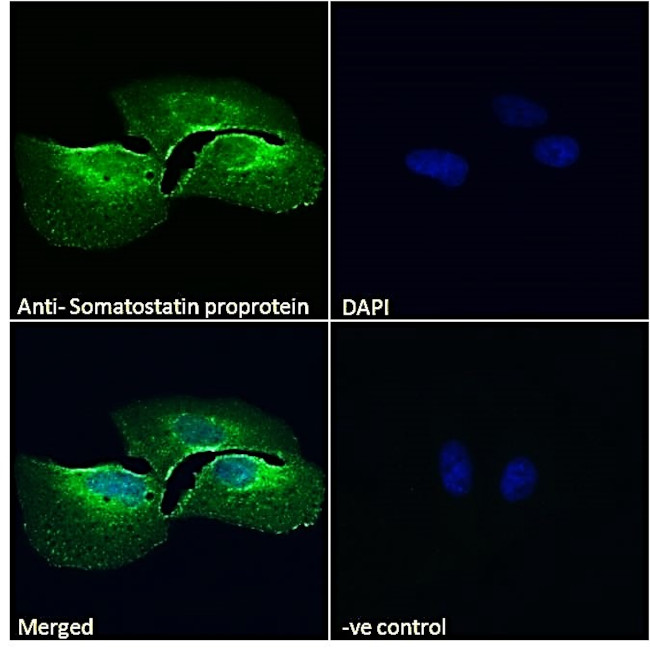 pro-Somatostatin Antibody in Immunocytochemistry (ICC/IF)