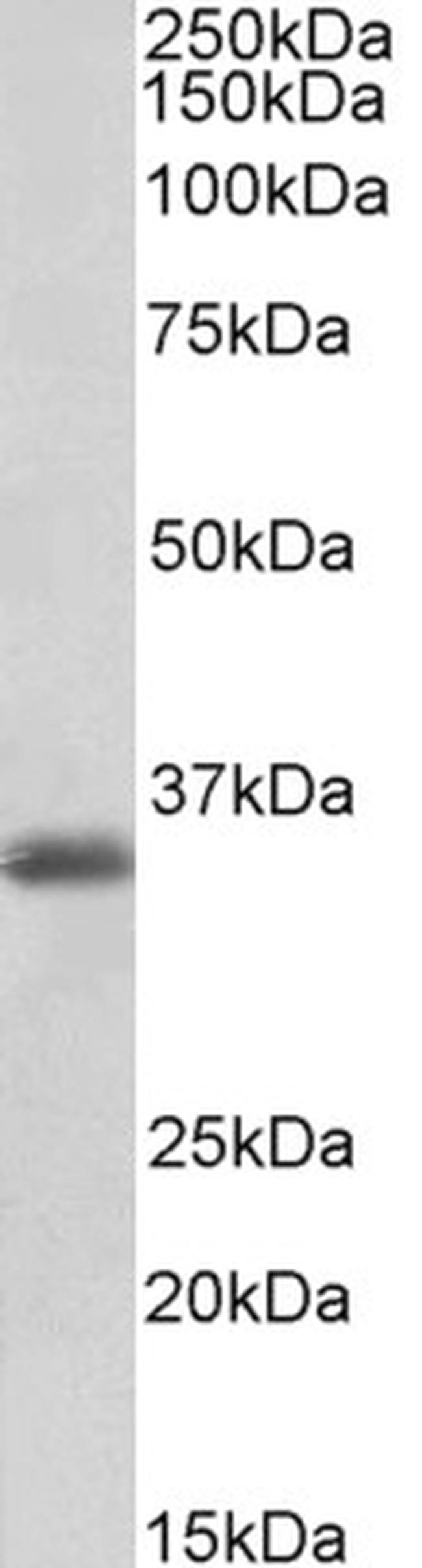 MDH1 Antibody in Western Blot (WB)