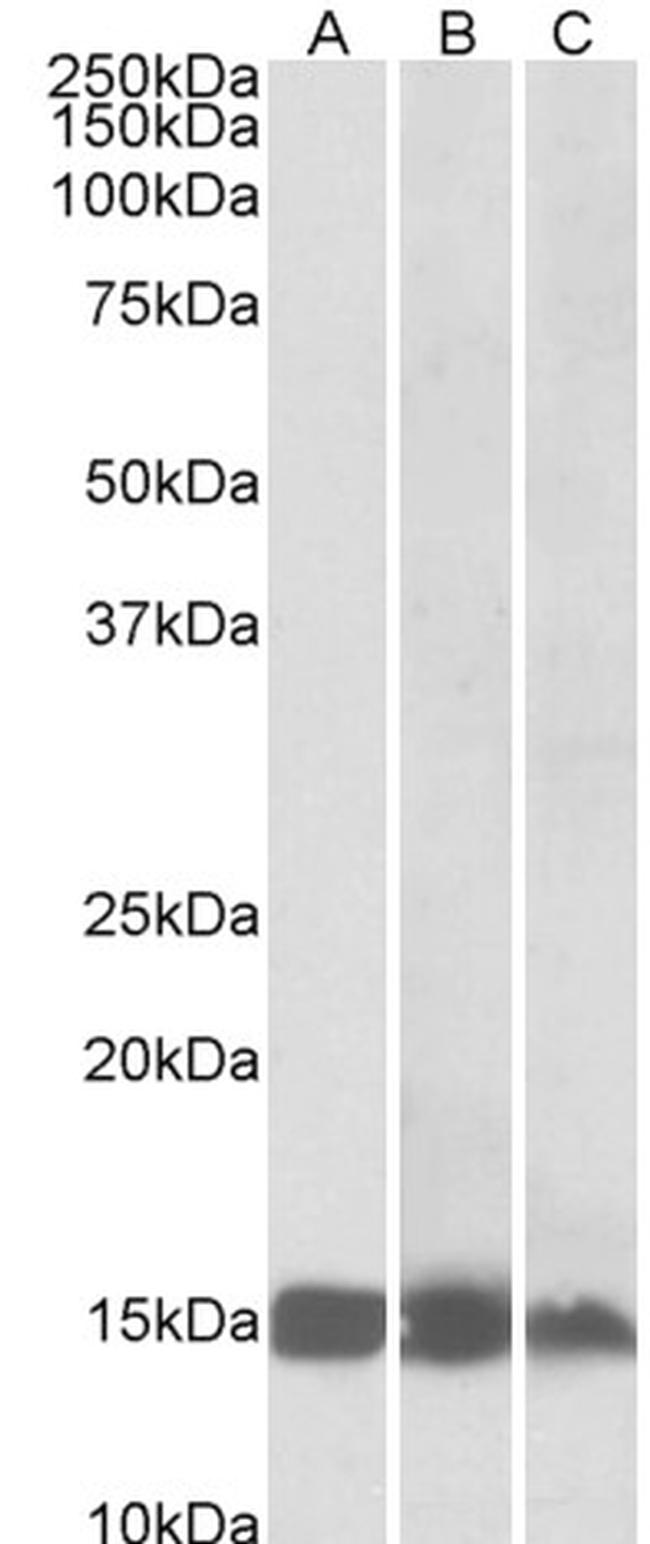 FABP3 Antibody in Western Blot (WB)