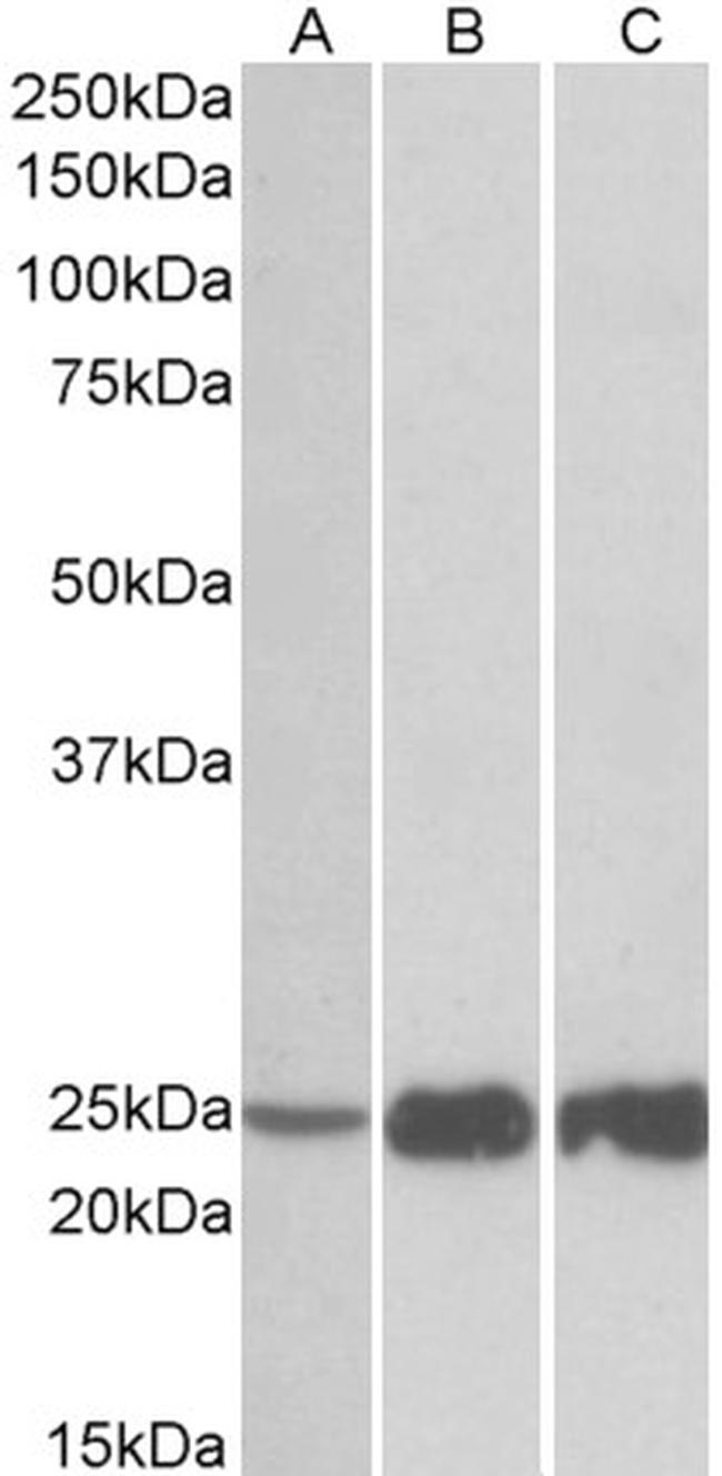 TNNI2 Antibody in Western Blot (WB)