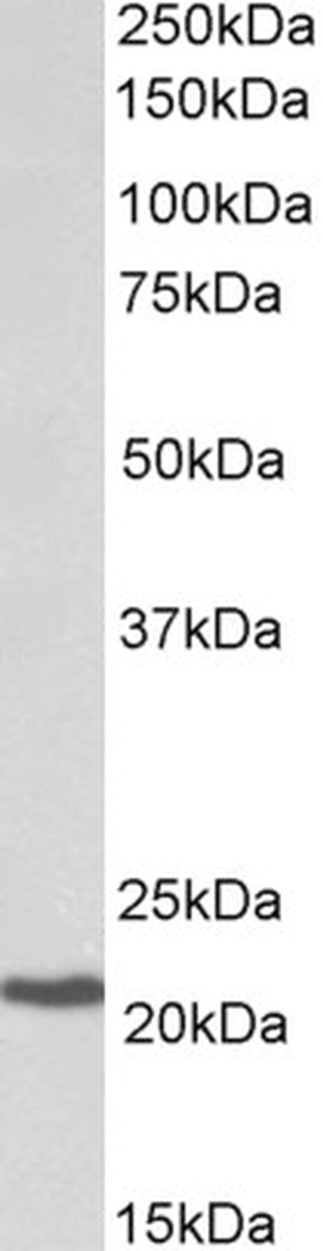 CBF beta Antibody in Western Blot (WB)