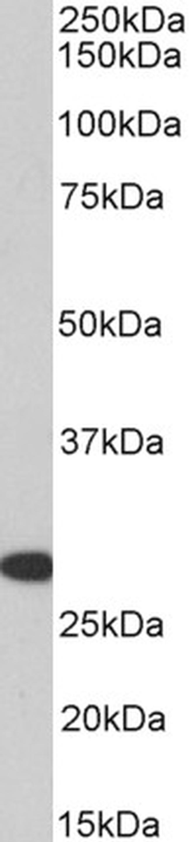 HOXA5 Antibody in Western Blot (WB)