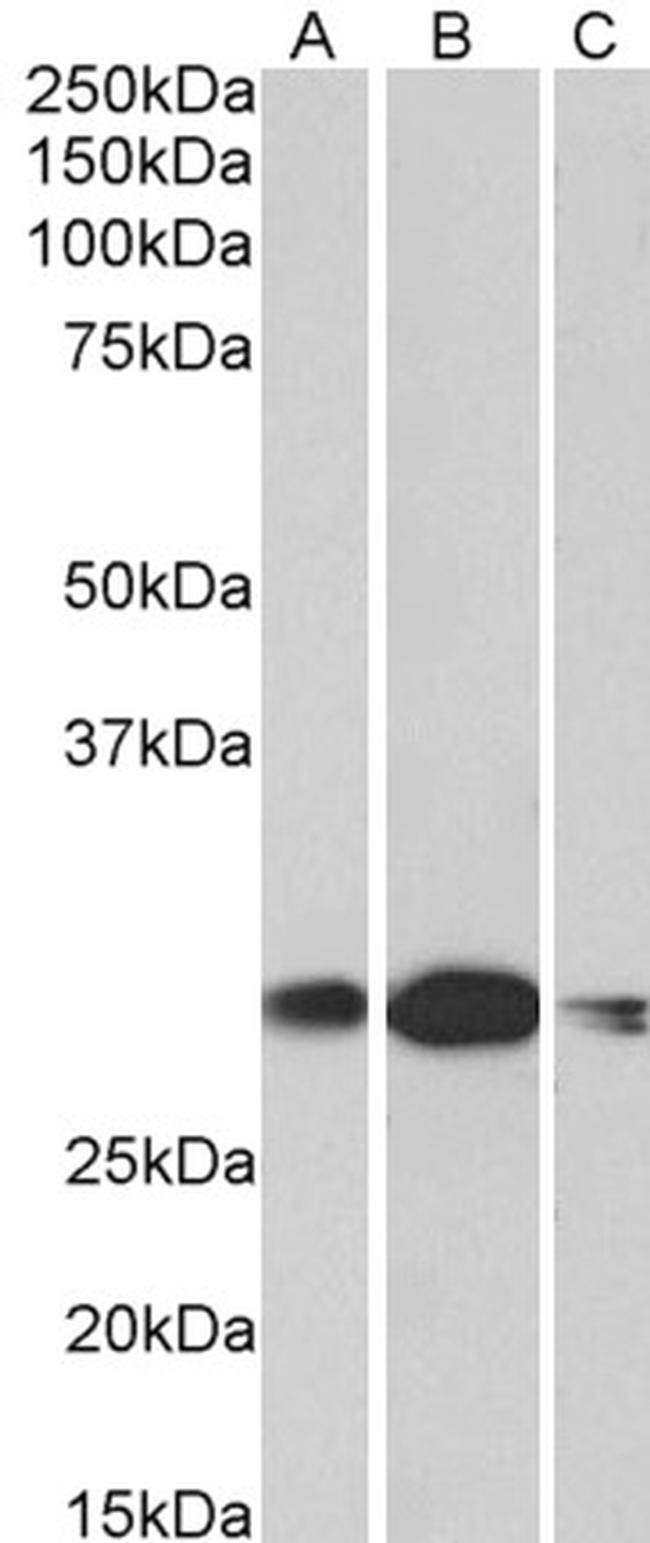HOXA5 Antibody in Western Blot (WB)