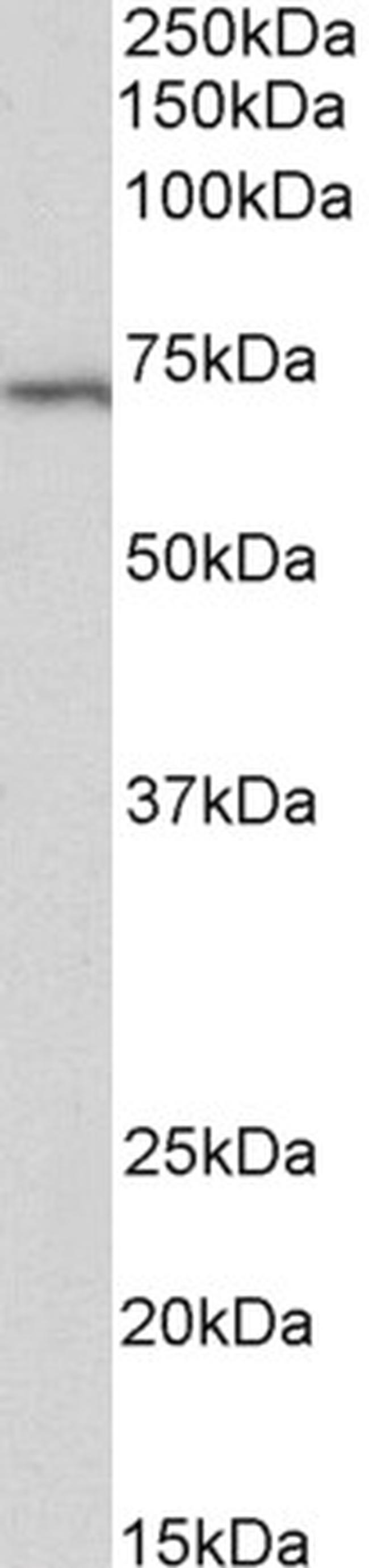 TRIF Antibody in Western Blot (WB)