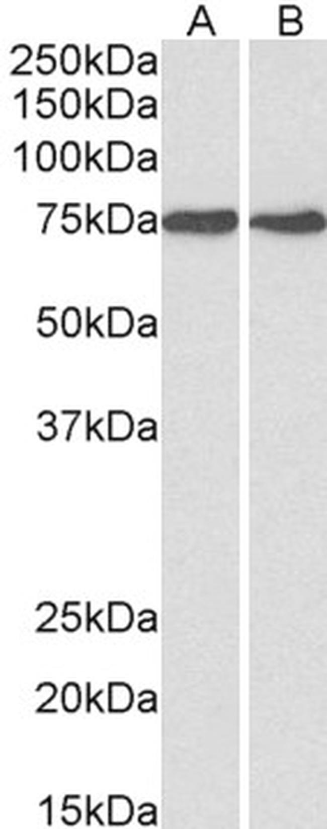 GRP78 Antibody in Western Blot (WB)