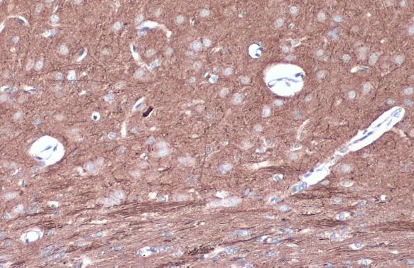 Phospho-PKC epsilon (Ser729) Antibody in Immunohistochemistry (Paraffin) (IHC (P))