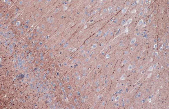 Phospho-PKC epsilon (Ser729) Antibody in Immunohistochemistry (Paraffin) (IHC (P))