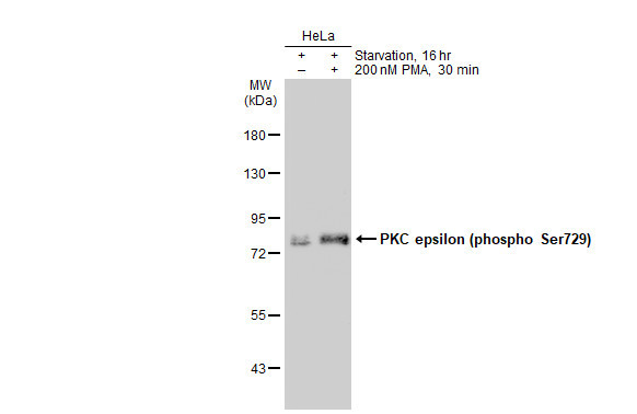 Phospho-PKC epsilon (Ser729) Antibody in Western Blot (WB)