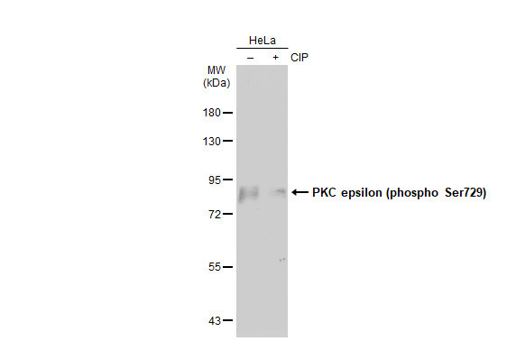 Phospho-PKC epsilon (Ser729) Antibody in Western Blot (WB)