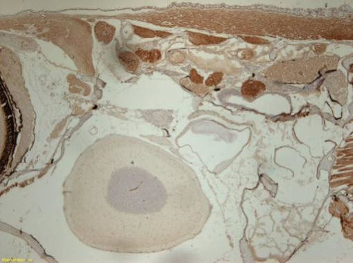 SMARCB1 Antibody in Immunohistochemistry (Paraffin) (IHC (P))