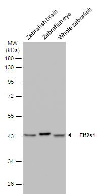 EIF2S1 Antibody in Western Blot (WB)