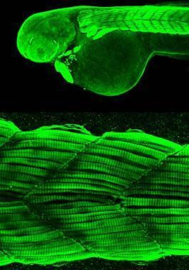 alpha-Cardiac Actin Antibody in Immunohistochemistry (PFA fixed) (IHC (PFA))