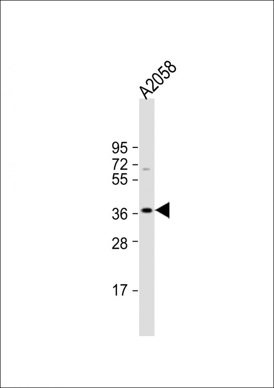 IGHA1 Antibody in Western Blot (WB)