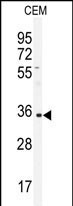 IGHA1 Antibody in Western Blot (WB)