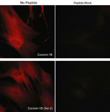 Phospho-Coronin 1B (Ser2) Antibody in Immunocytochemistry (ICC/IF)