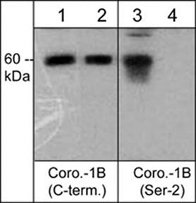 Phospho-Coronin 1B (Ser2) Antibody in Western Blot (WB)