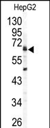 Arylsulfatase B Antibody in Western Blot (WB)