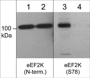 Phospho-EEF2K (Ser78) Antibody in Western Blot (WB)